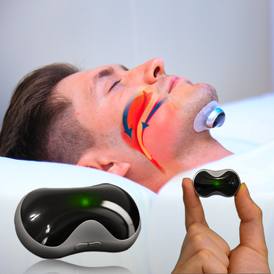 Napco Anti-Schnarch Gerät | Für Ruhige Sommernächte und Optimalen Schlaf