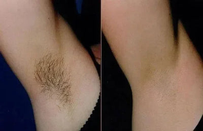 SanftHaut™ Lang anhaltendes geschmeidiges Selbstvertrauen